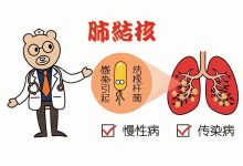 肺结核的艾灸辅助治疗：温和调理，促进康复